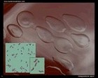 Campylobacter jejuni with microscopy